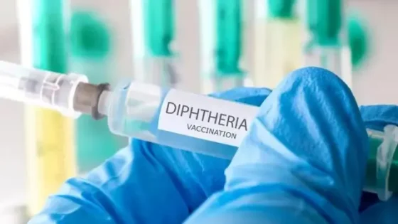 الدفتيريا تعود إلى الواجهة باليوسفية.. إصابة جديدة مؤكدة